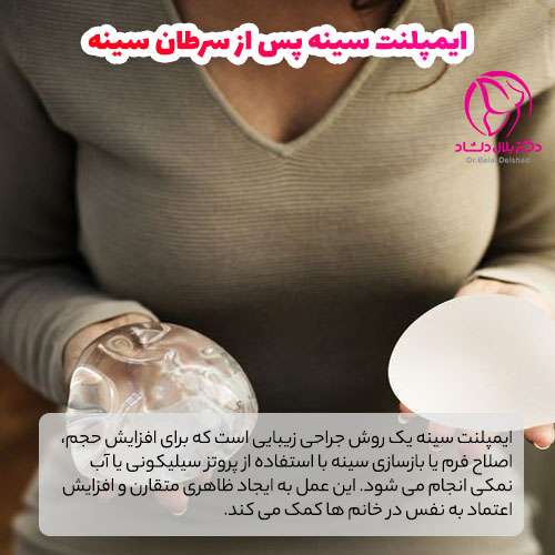 ایمپلنت سینه پس از سرطان سینه